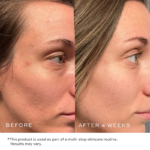 Non-Greasy Beauty Hyaluronic Acid Serum - Image 2